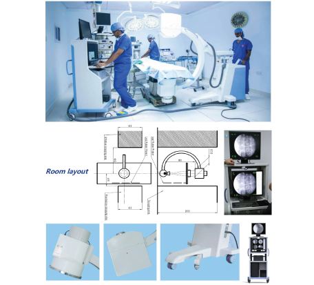 High-Frequency-Mobile-Digital-C-Arm-System-.jpg