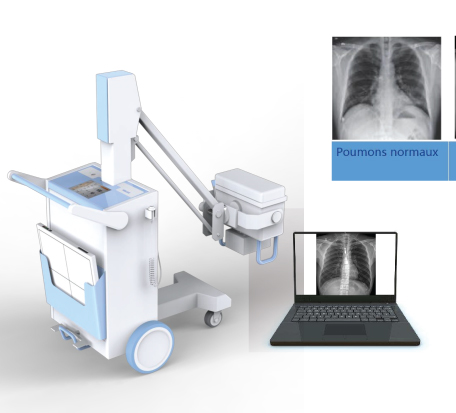 MH51-Mobile-X-Ray-5KW.jpg